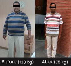 Dr. VIvek Bindal Robotic and Bariatric Surgeon success story